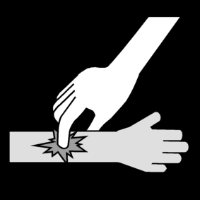 pinch